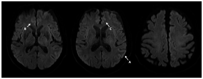 Figure 13