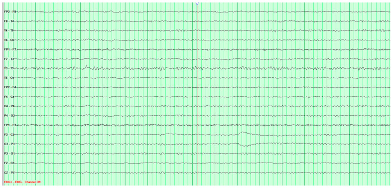 Figure 14