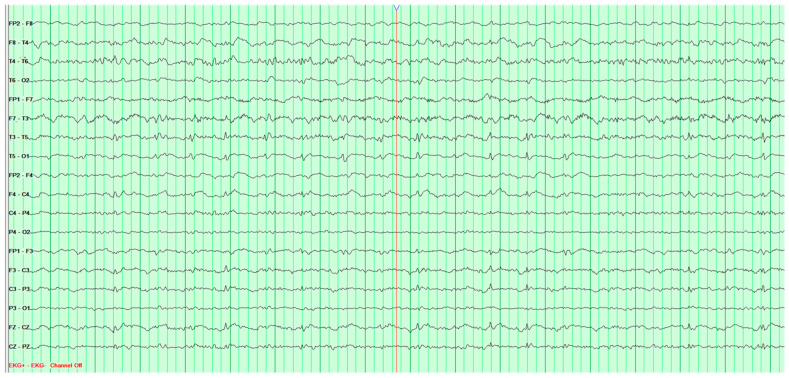 Figure 15