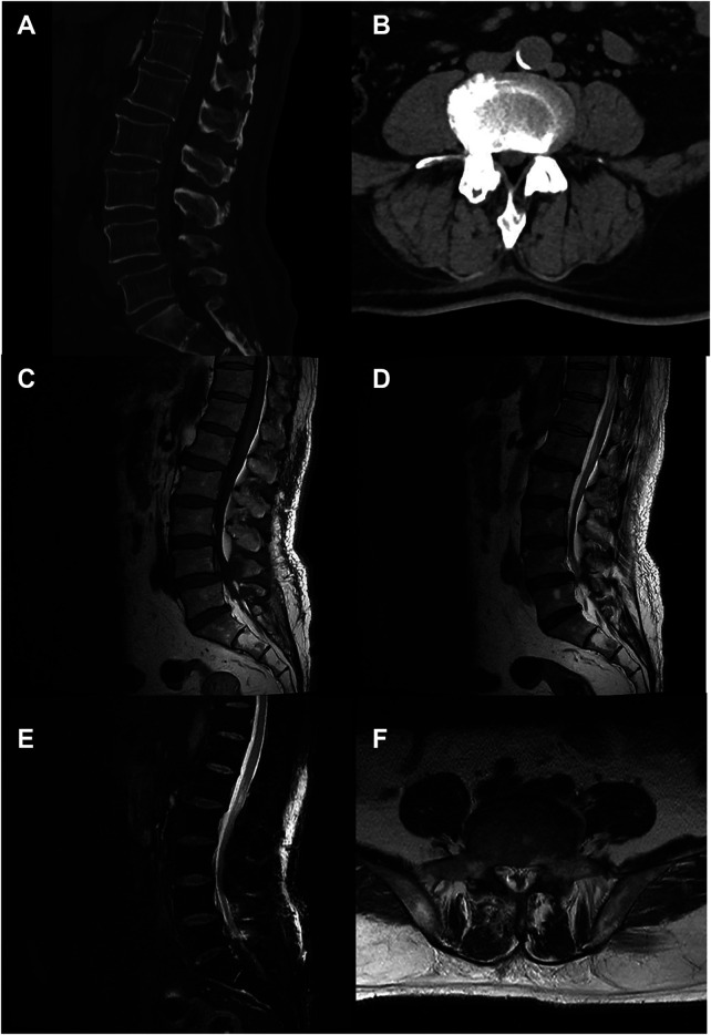 Figure 3