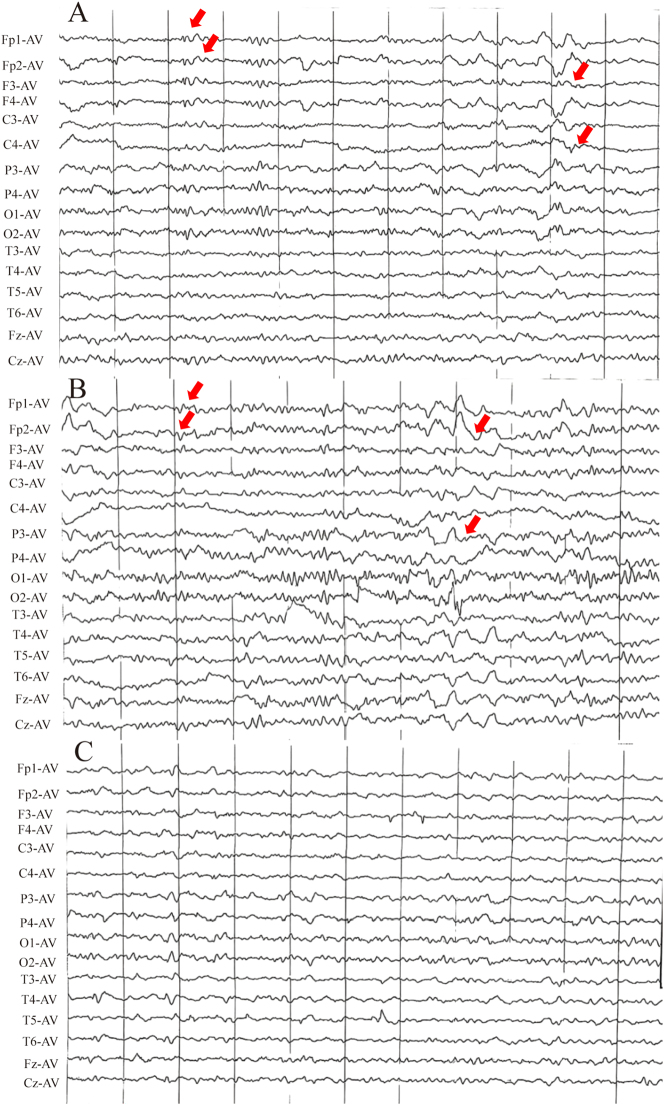 Figure 2