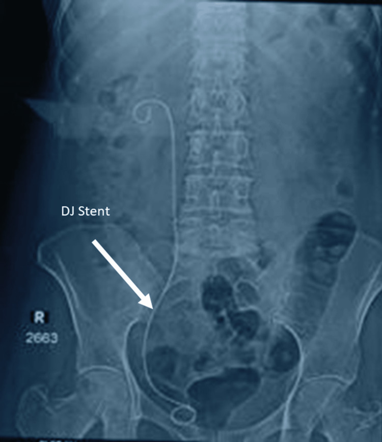 Figure 5