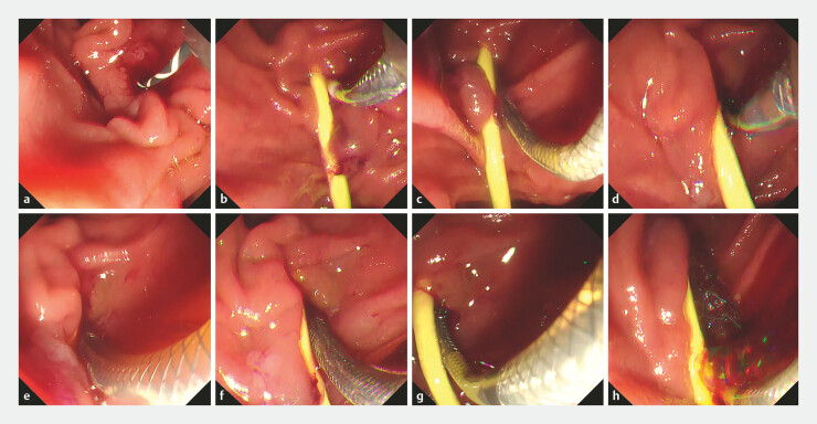 Fig. 2