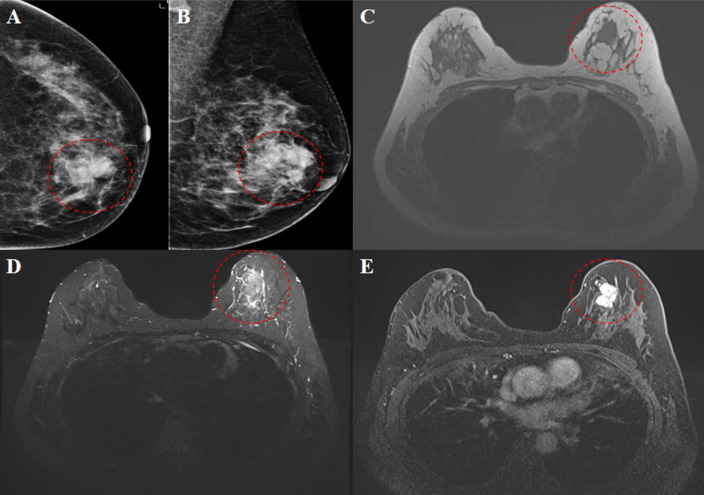 Figure 2