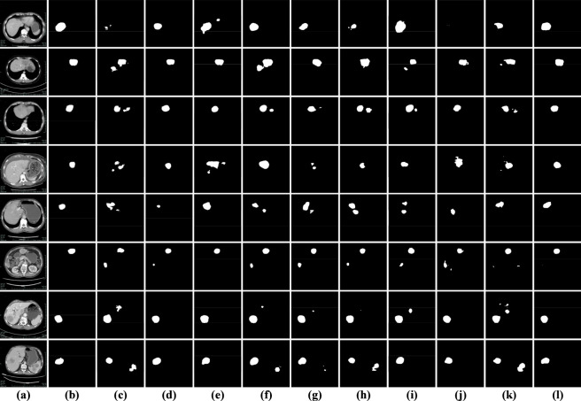 FIGURE 14