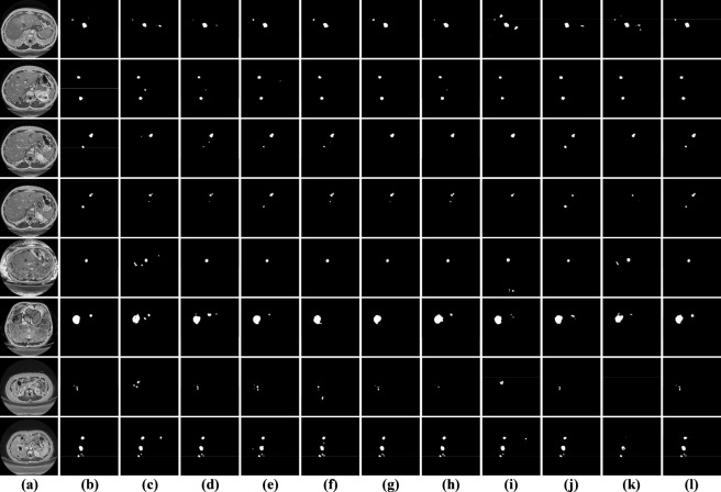 FIGURE 15