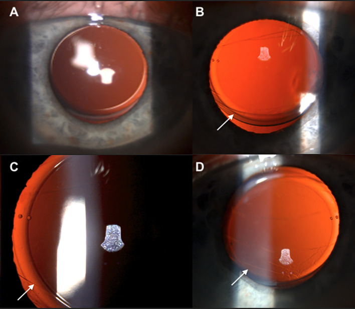 Figure 1
