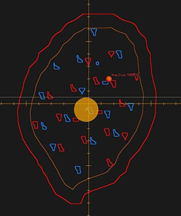 Figure 2