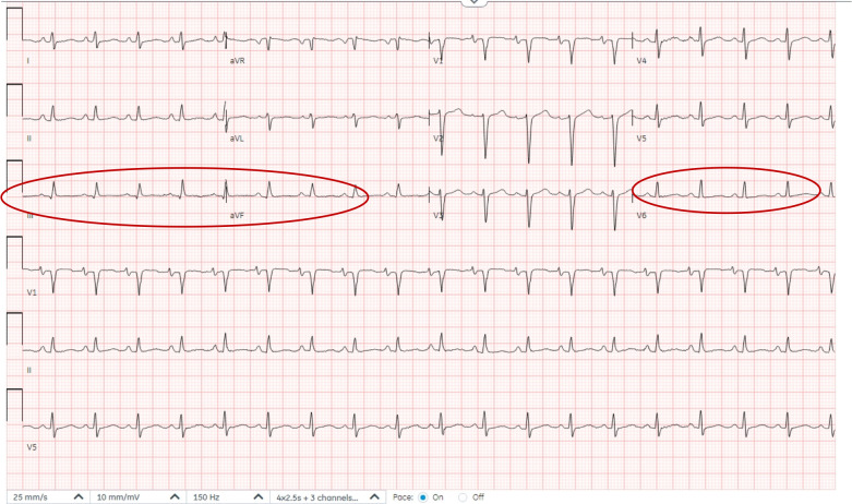 Figure 2