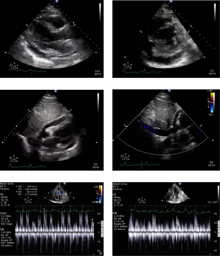 Figure 3