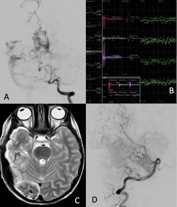 Fig. 2
