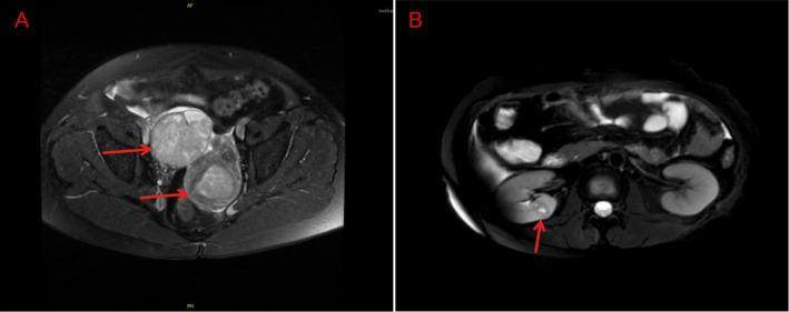 Figure 1