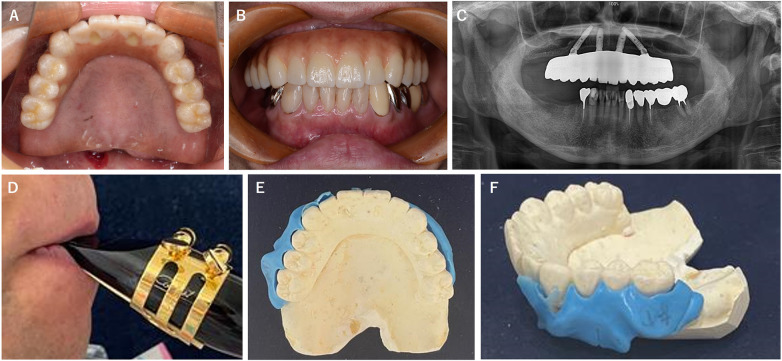 Figure 1