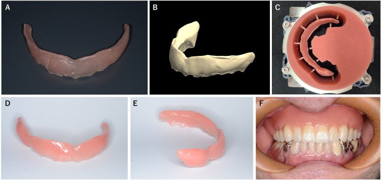 Figure 2