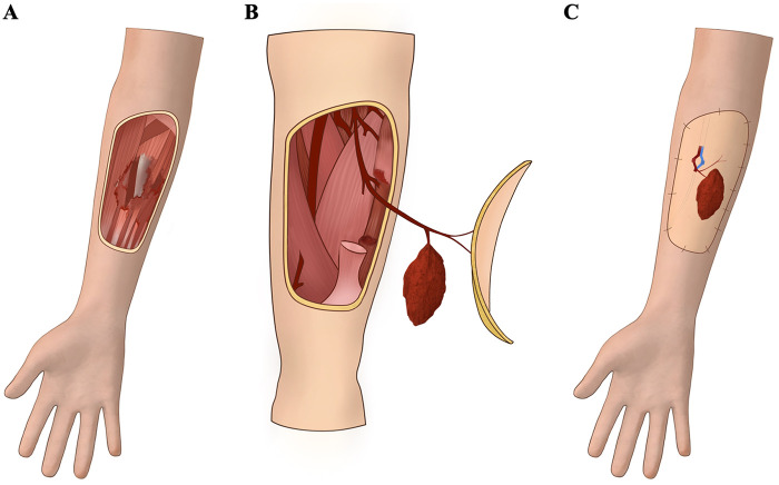 Figure 1