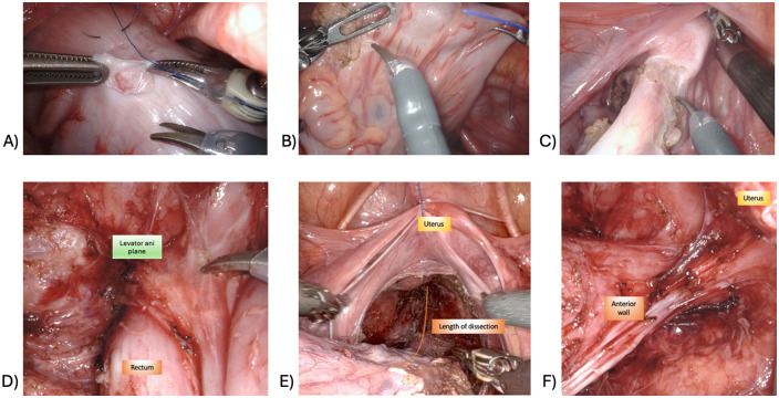 Figure 3