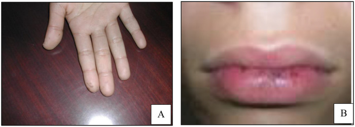Figure 1