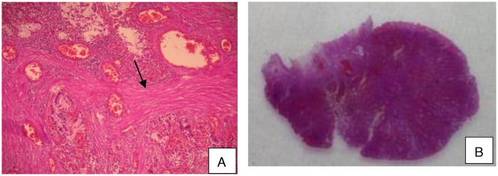 Figure 3