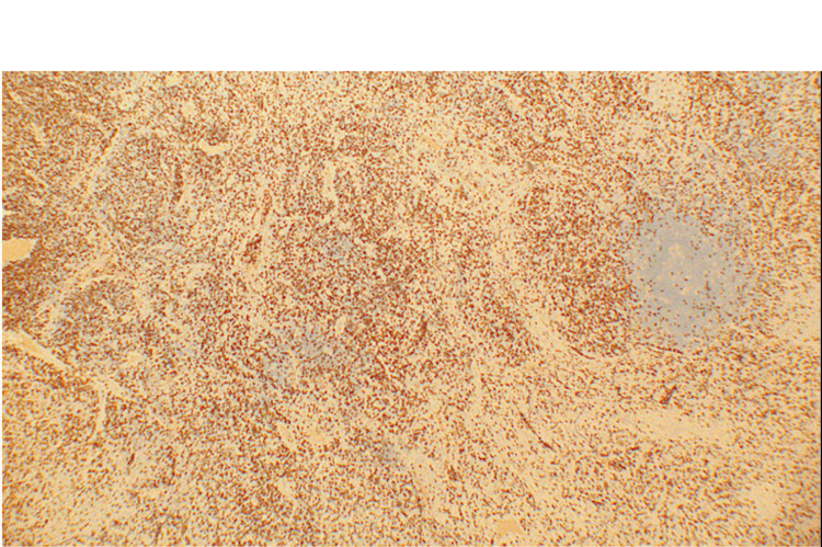 Figure 9
