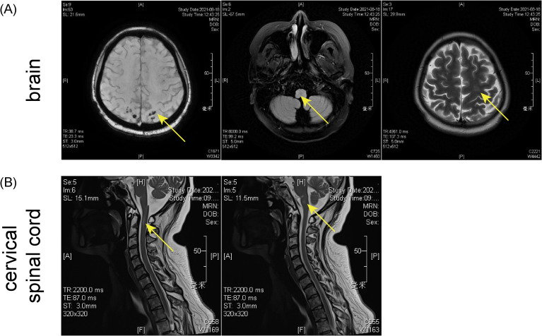 Figure 2