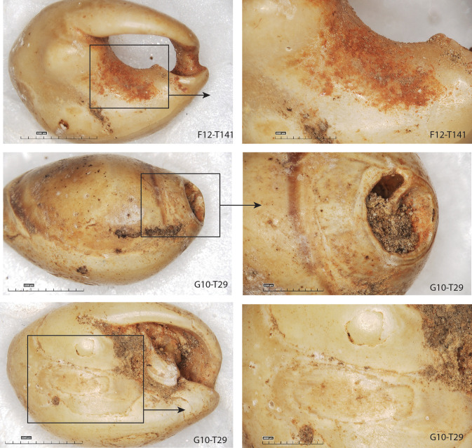 Fig 15