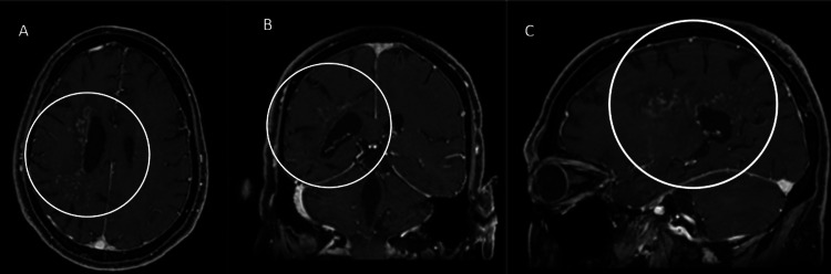 Figure 11
