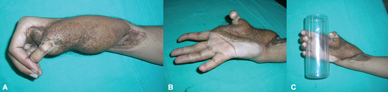 Fig. 13