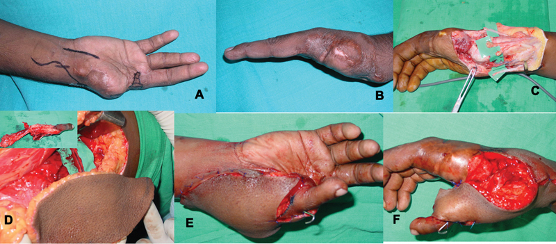 Fig. 14