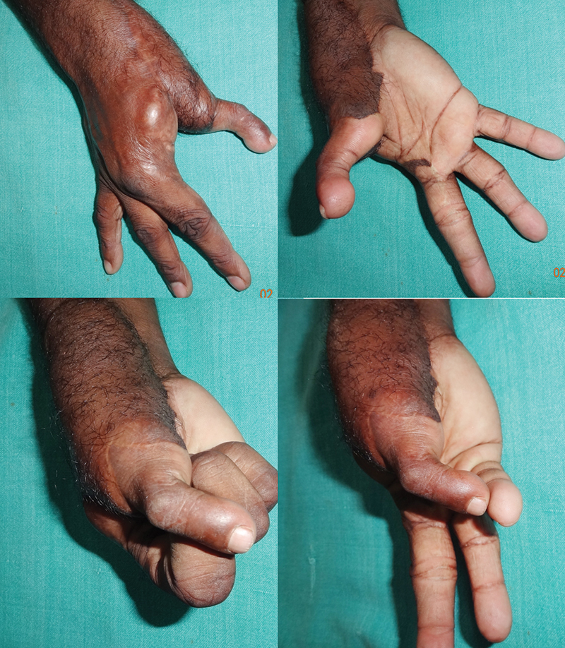 Fig. 15