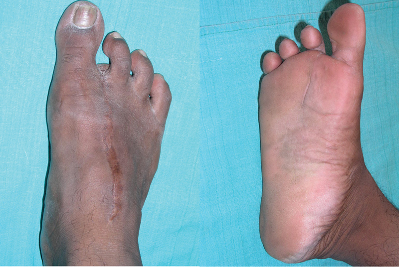 Fig. 16