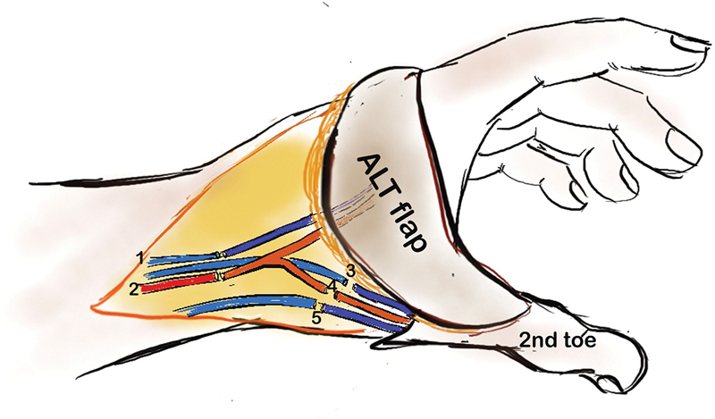 Fig. 4