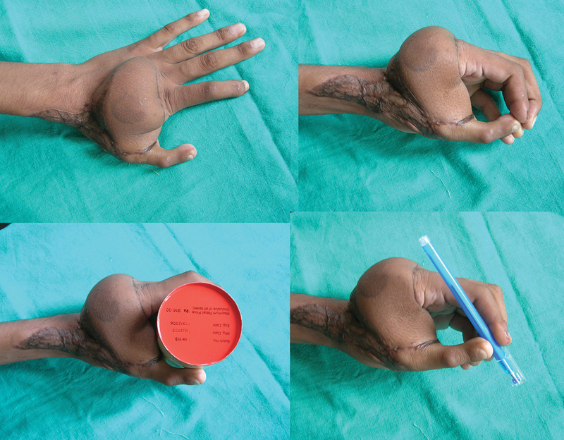Fig. 6
