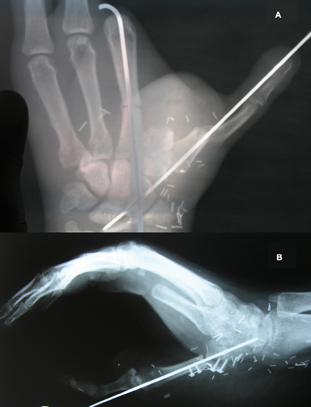Fig. 7