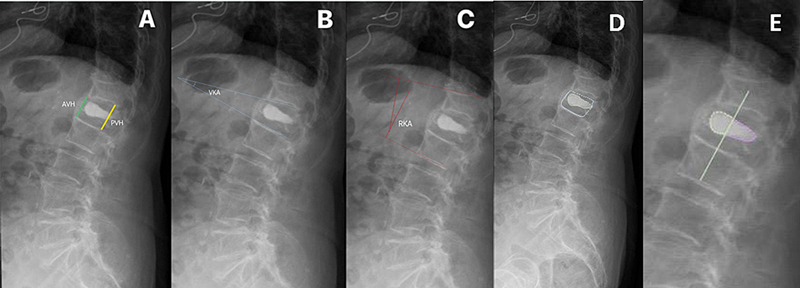 Fig. 1