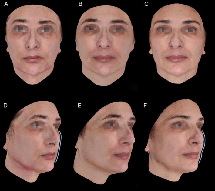 FIGURE 6