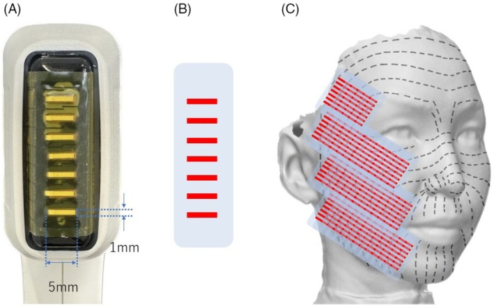 FIGURE 1