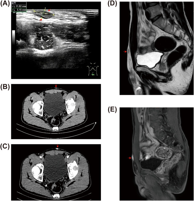 Figure 2