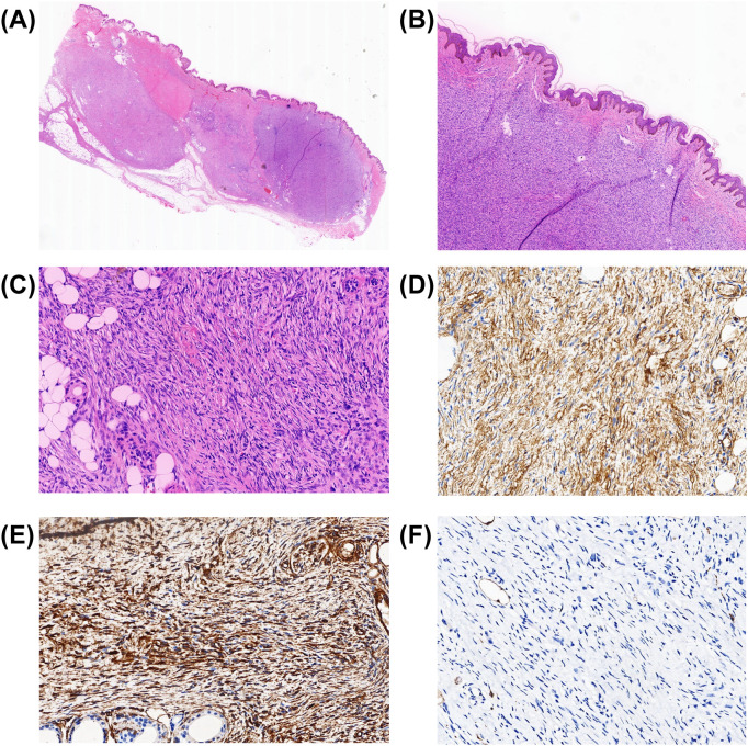 Figure 3