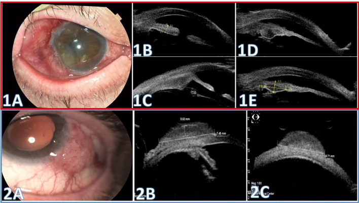 Figure 2