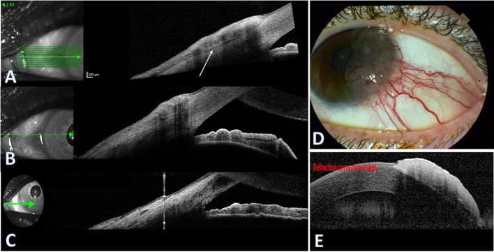 Figure 3