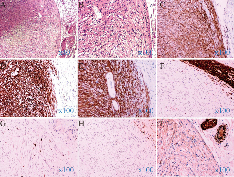 Figure 2