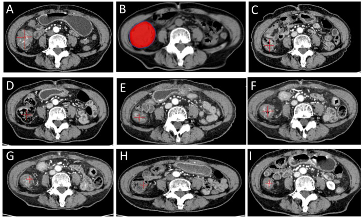 Figure 1