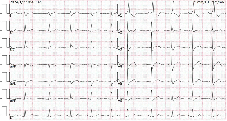 Figure 2