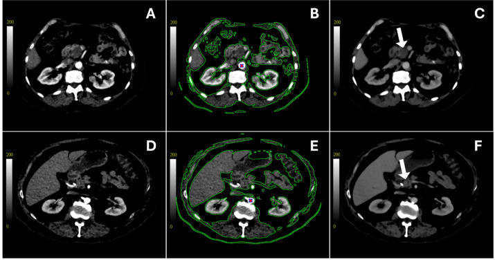Figure 2
