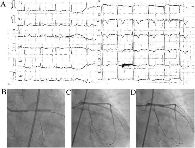 Figure 4