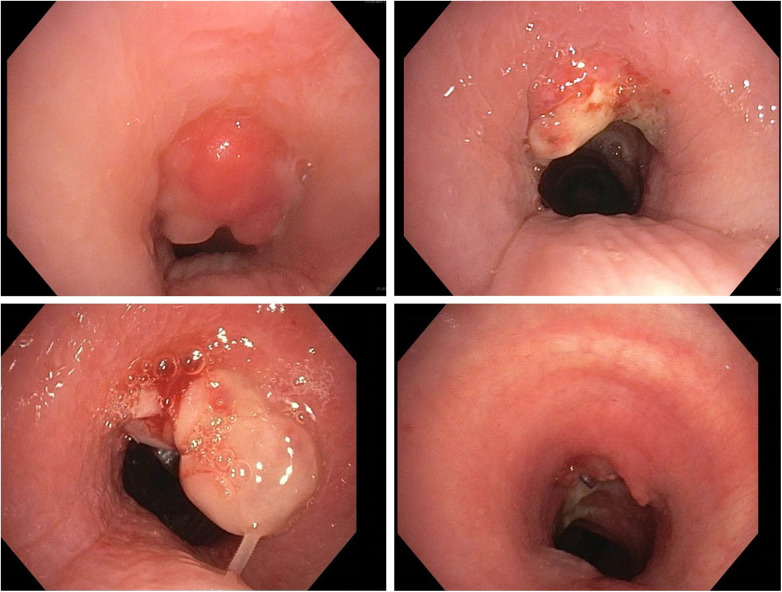 Figure 3