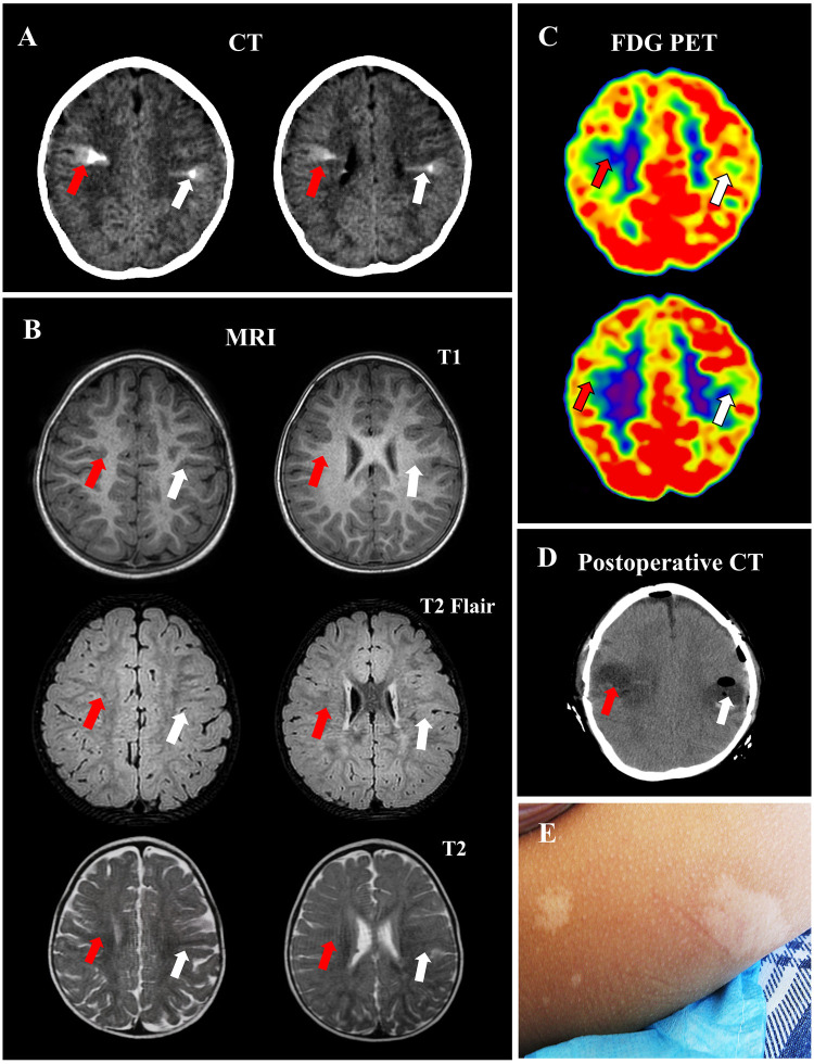 Figure 2