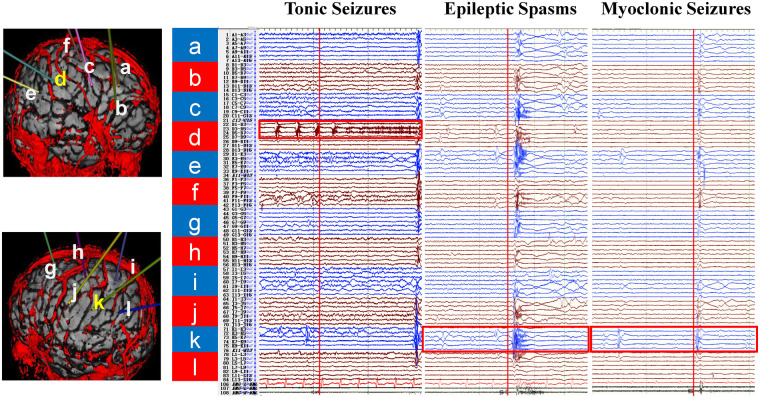 Figure 3