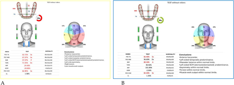Figure 11