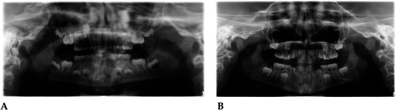Figure 12